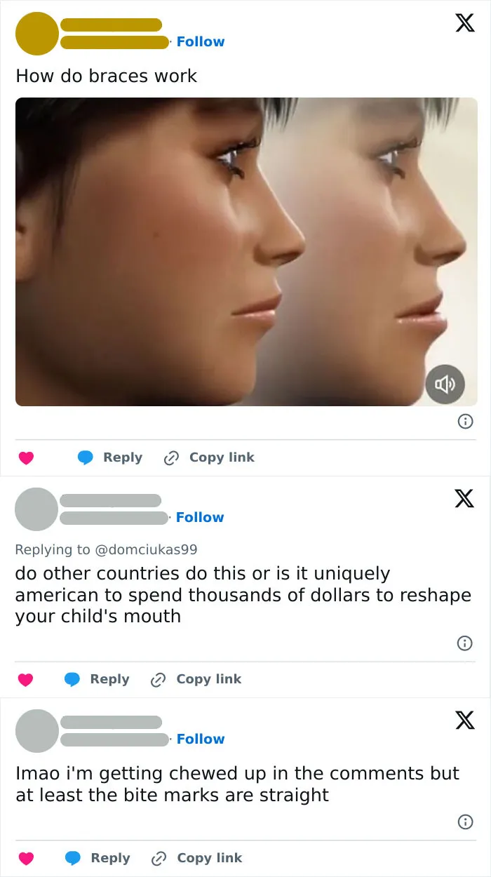 Atleast The Bite Marks Are Straight