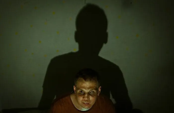 1st Place, Portrait: The Bitter Face Of War By Erçin Ertürk, Turkey