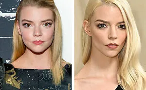 “Looked Better Before”: 17 Stars People Say Look Unrecognizable After Plastic Surgery