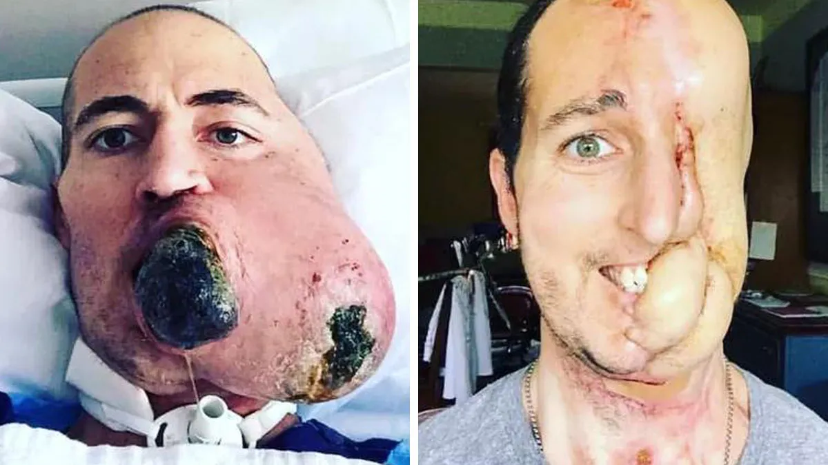 50 Interesting Medical Cases That Might Make You Appreciate The Human Body (New Pics)