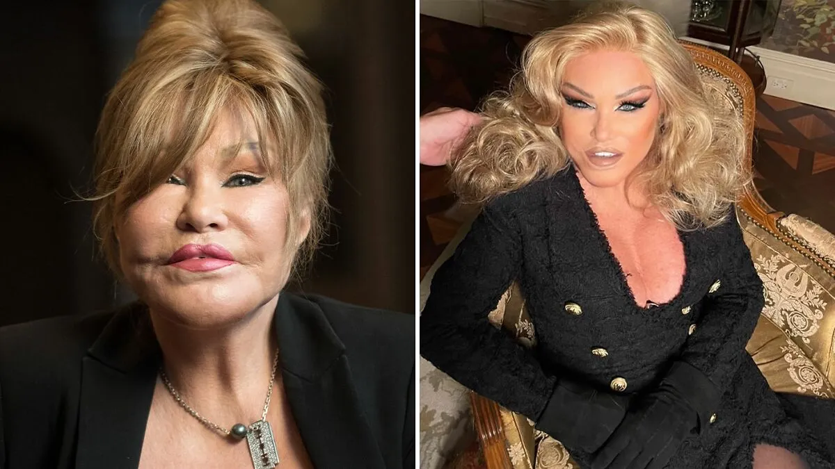 'Catwoman' Jocelyn Wildenstein, Notorious For Extreme Plastic Surgeries, Passes Away At 84