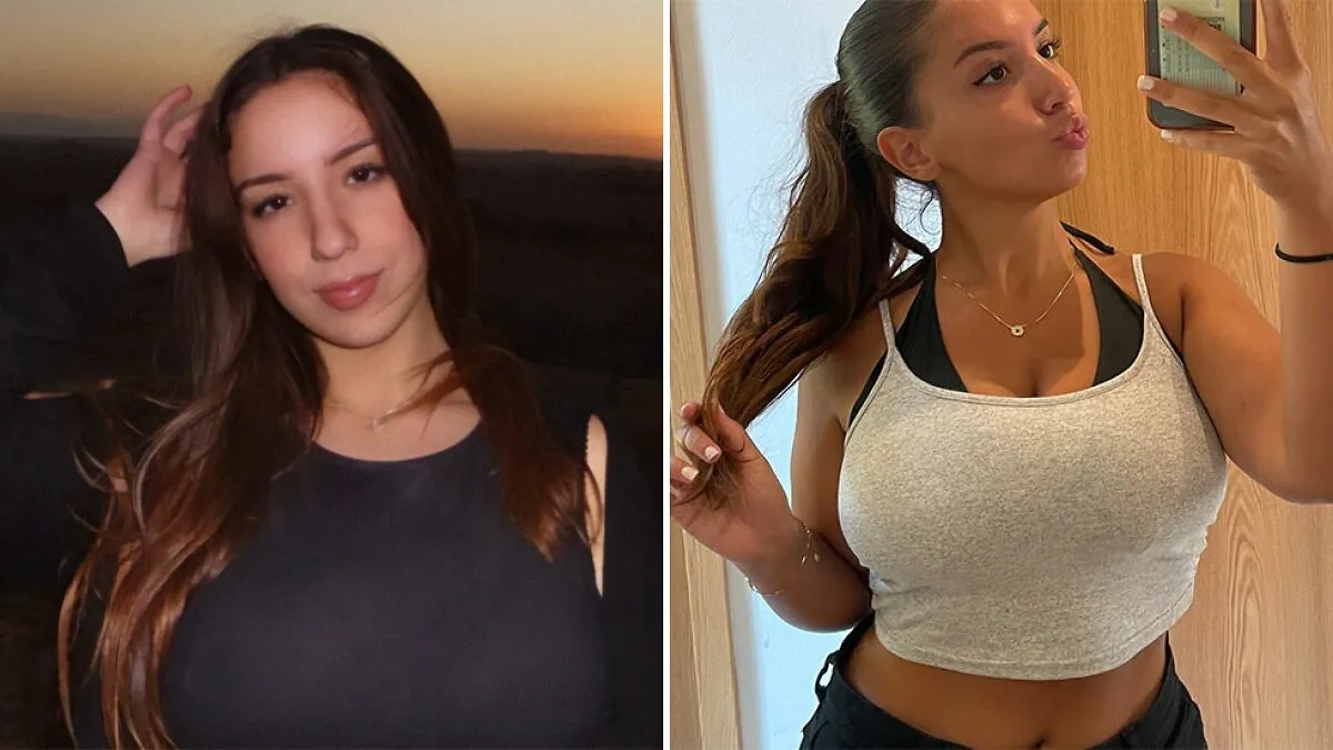 "Always In Pain": Woman’s 30J Breast Reduction Plea Rejected, Faces Harassment