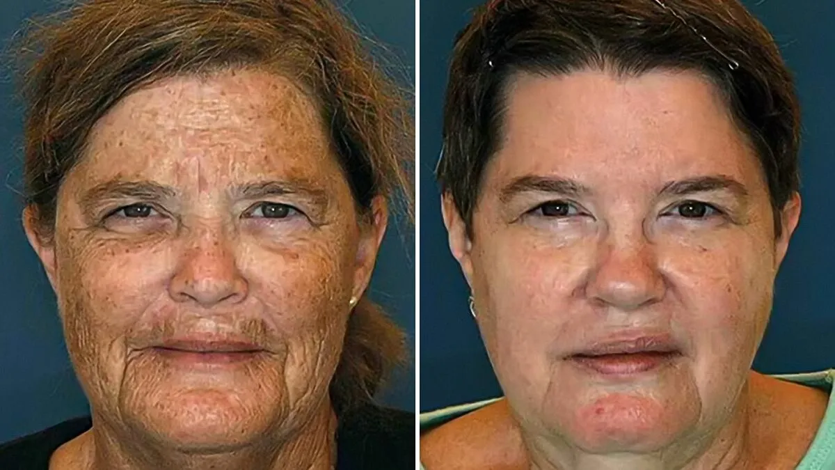 People Take Stock Of Own Lifestyle Choices After Twin Study Goes Viral: “Can See A Huge Difference”