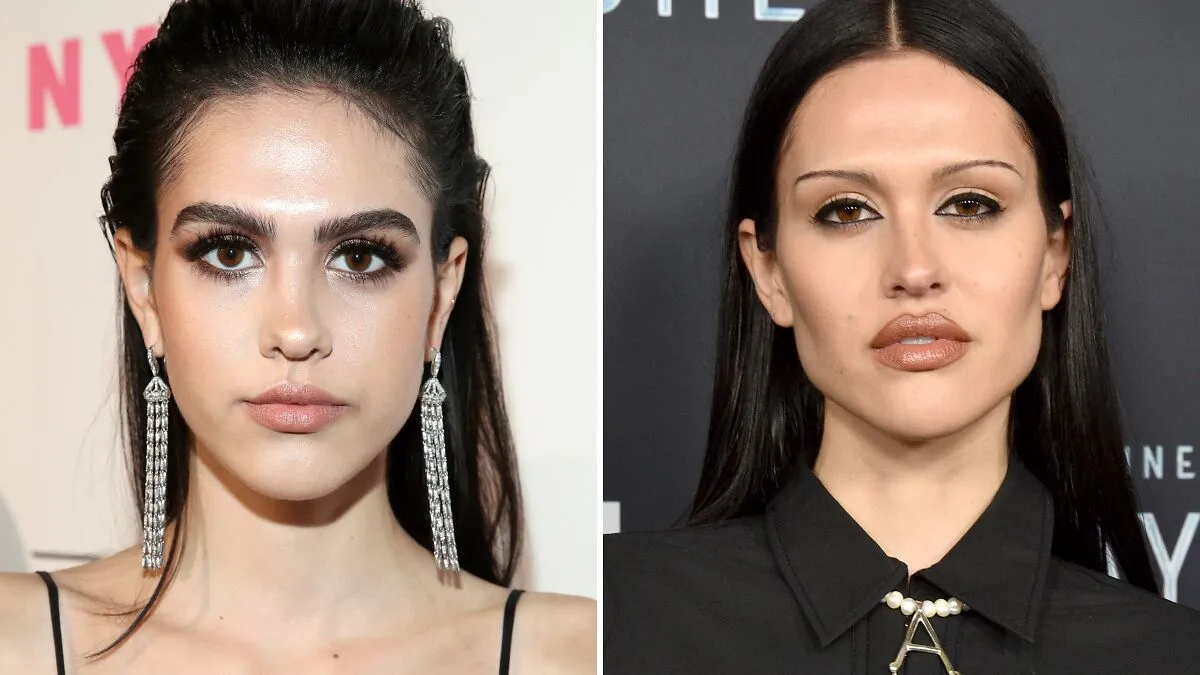 “Looked Better Before”: 17 Stars People Say Look Unrecognizable After Plastic Surgery