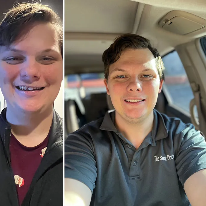 I’ve Always Been Ashamed Of My Teeth, And For Our 7th Anniversary My Wife Completely Changed My Life