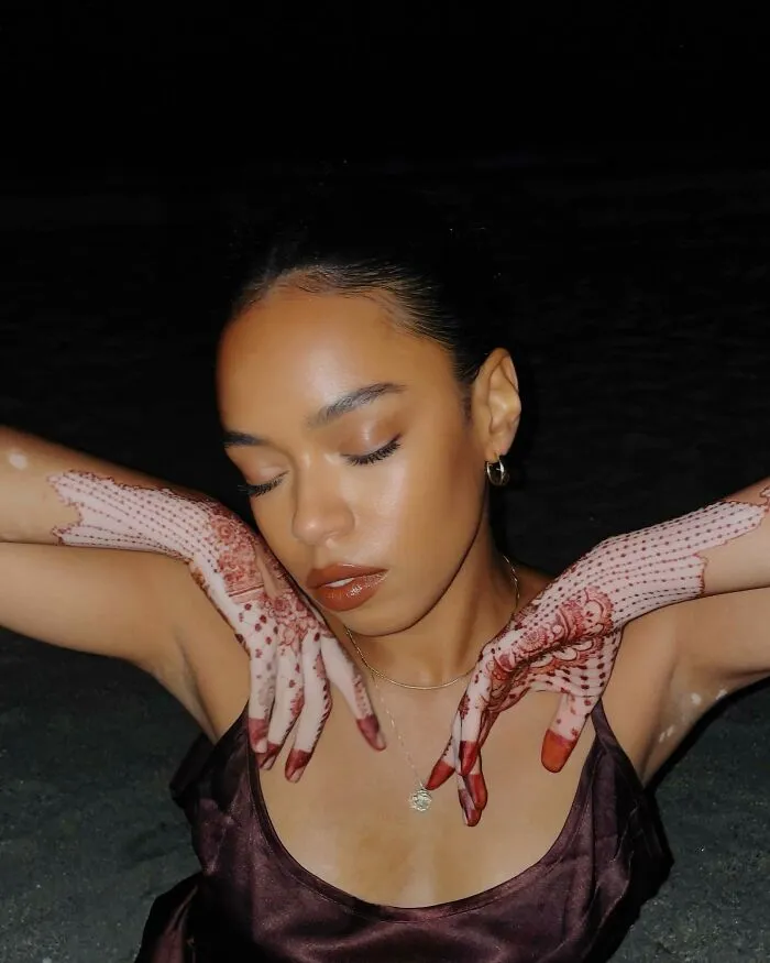 Dancer-Turned-Artist Amara Aleman Turns Her Vitiligo Into Vibrant Body Art (20 Pics)