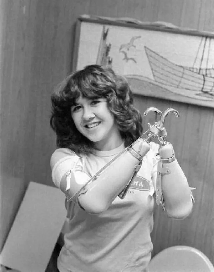 Mary Vincent Photographed In 1978. 15yo Mary Survived Being Assaulted, Having Her Arms Cut Off With An Axe By Her Attacker, Being Thrown Down A 30 Ft Cliff And Left For Dead. She Packed The Stumps With Mud And Climbed Back Up, Walked 3 Miles Naked In Search Of Help. I've Linked To Her Story Below