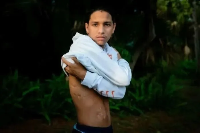 In 2018, The Parkland School Shooting Incident Happened. A 15 Year Old Named Anthony Borges Successfully Stopped The Shooter From Entering His Classroom By Using His Body To Keep The Door Shut