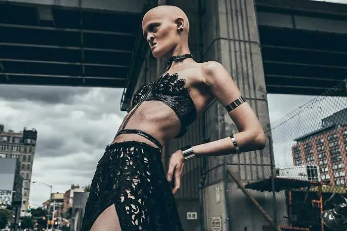 Meet Melanie Gaydos, A Striking Model Who Has Made The Most Of Her Rare Genetic Disorder
