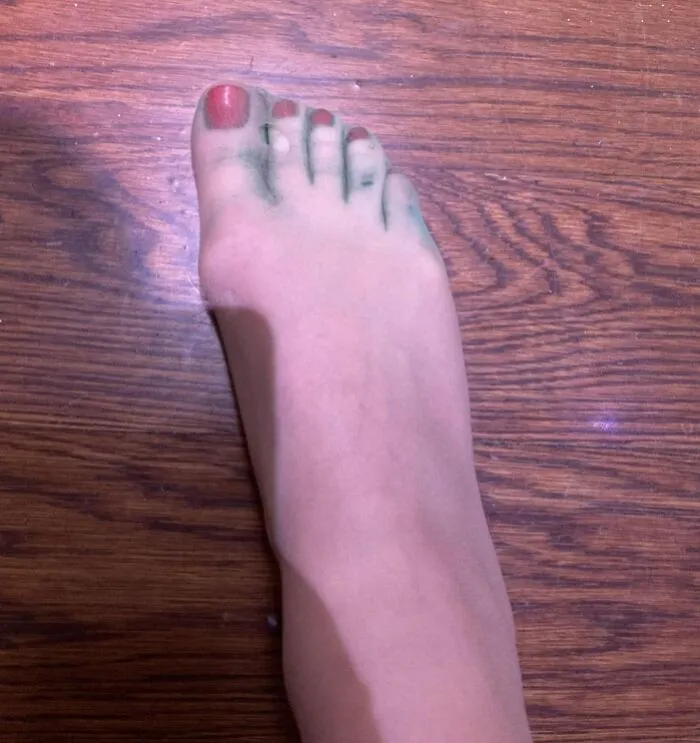 I Went To A Wedding At A Mansion, And Discovered That They Had Painted The Grass Green. This Is My Feet After Walking Through It In Closed-Toed Shoes