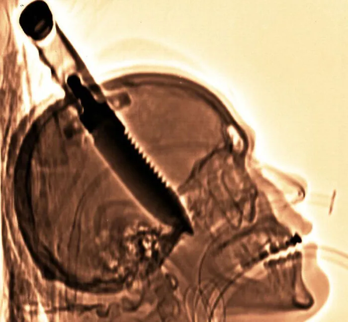 En 1998, Michael Hill fue apuñalado en el cerebro con una hoja dentada de 20 centímetros cuando abría la puerta en la casa de un amigo.