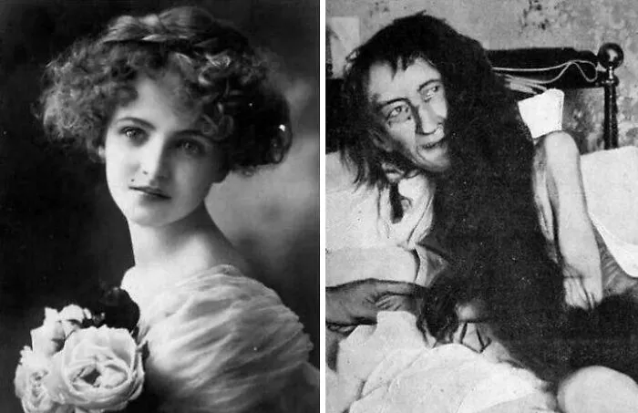 La chica perdida, 1874: Blanche Monnier era una dama de la alta sociedad parisina conocida por su belleza