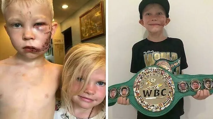 El 9 de julio de 2020, Bridger Walker, de 6 años, salvó a su hermana pequeña del ataque de un perro. Le dieron 90 puntos por todo el cuerpo, pero salvó a su hermana de 3 años de una muerte segura.