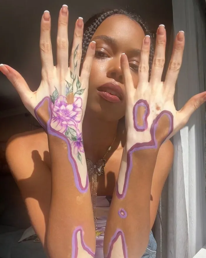 Dancer-Turned-Artist Amara Aleman Turns Her Vitiligo Into Vibrant Body Art (20 Pics)
