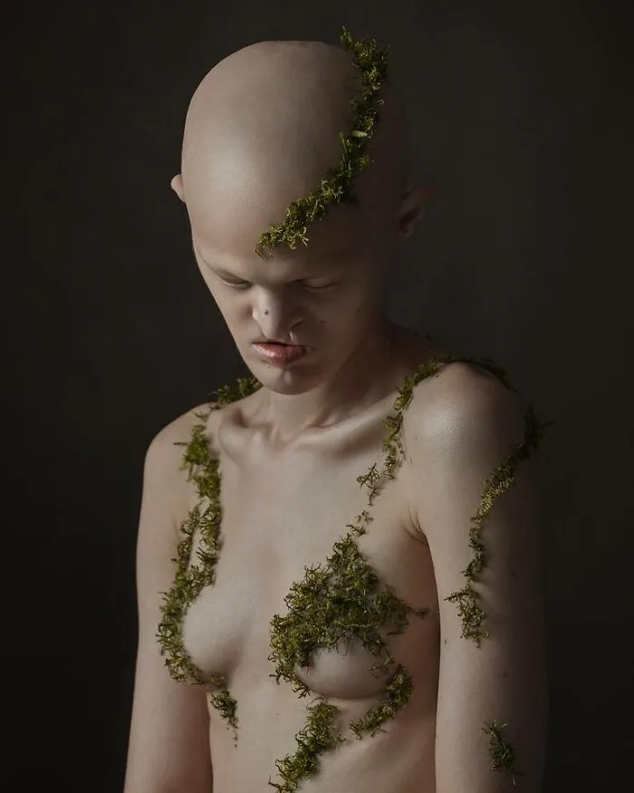 Meet Melanie Gaydos, A Striking Model Who Has Made The Most Of Her Rare Genetic Disorder