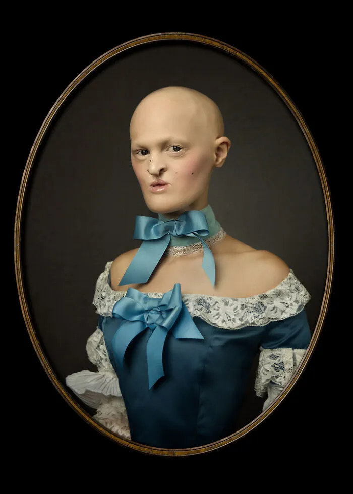 Meet Melanie Gaydos, A Striking Model Who Has Made The Most Of Her Rare Genetic Disorder