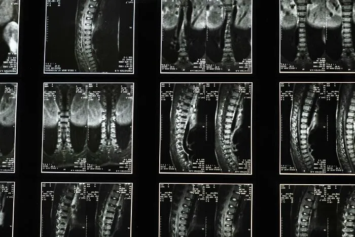 29 Traits And Things People Have Been Genetically Blessed And Cursed With 