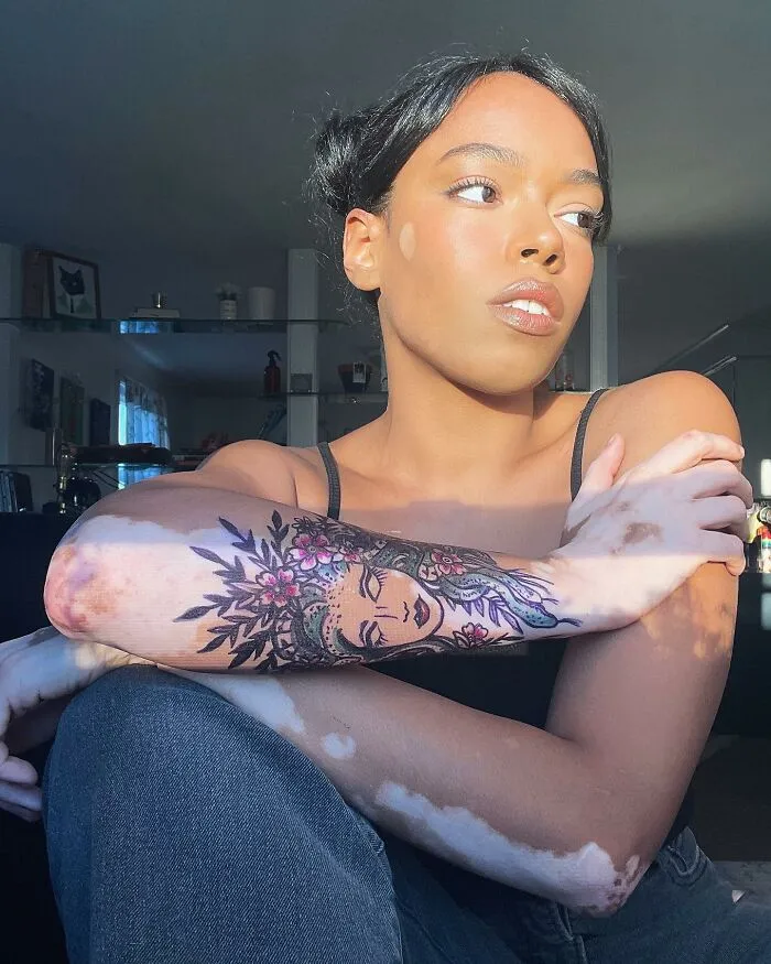 Dancer-Turned-Artist Amara Aleman Turns Her Vitiligo Into Vibrant Body Art (20 Pics)