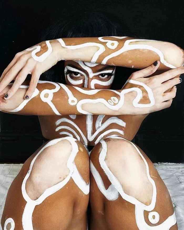 Dancer-Turned-Artist Amara Aleman Turns Her Vitiligo Into Vibrant Body Art (20 Pics)