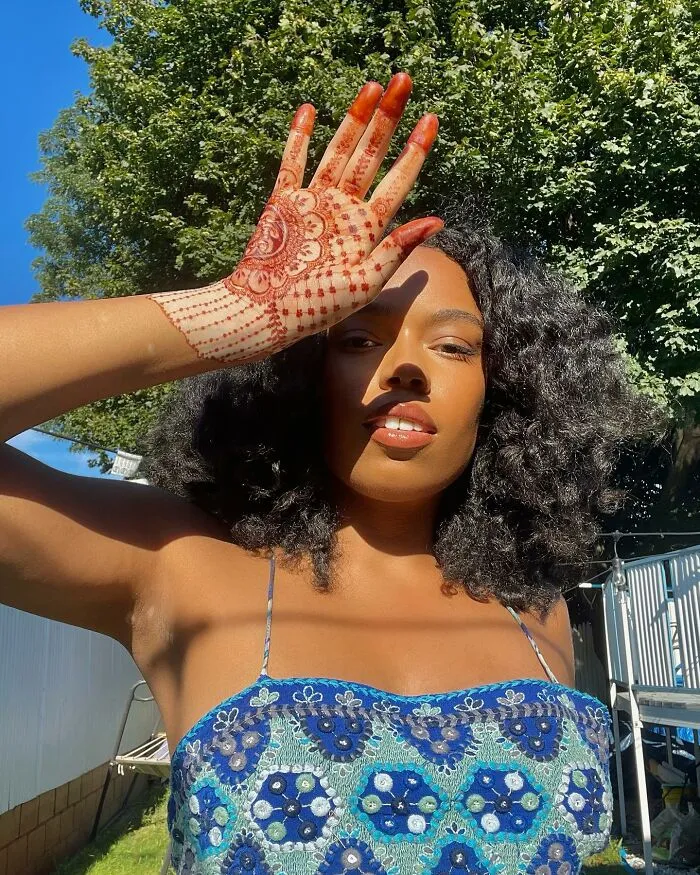 Dancer-Turned-Artist Amara Aleman Turns Her Vitiligo Into Vibrant Body Art (20 Pics)