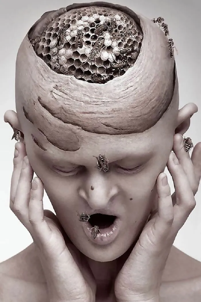 Meet Melanie Gaydos, A Striking Model Who Has Made The Most Of Her Rare Genetic Disorder