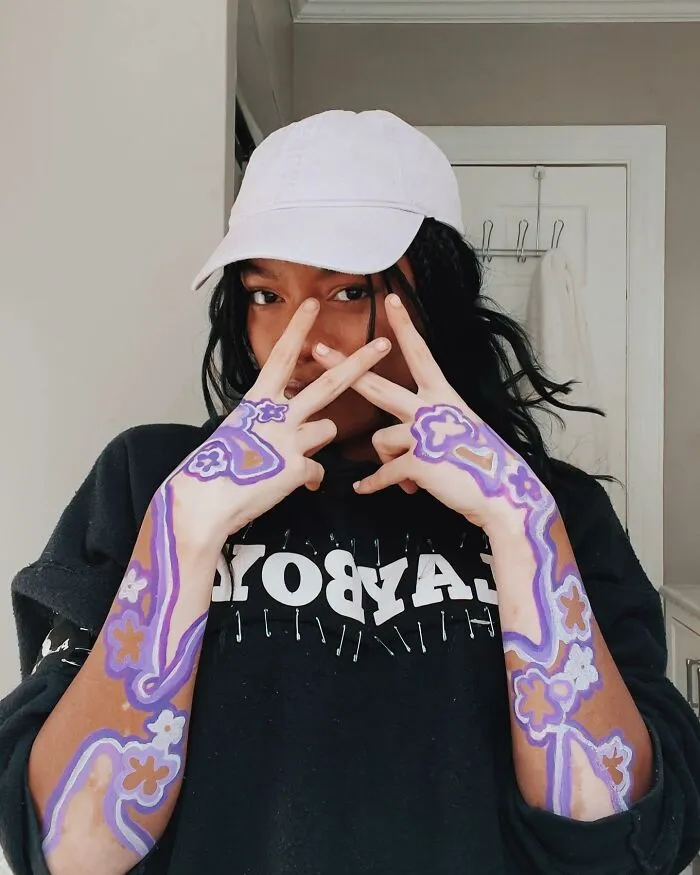 Dancer-Turned-Artist Amara Aleman Turns Her Vitiligo Into Vibrant Body Art (20 Pics)