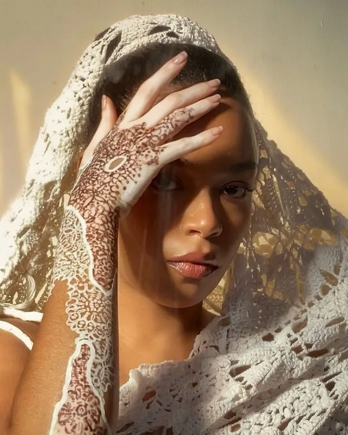 Dancer-Turned-Artist Amara Aleman Turns Her Vitiligo Into Vibrant Body Art (20 Pics)