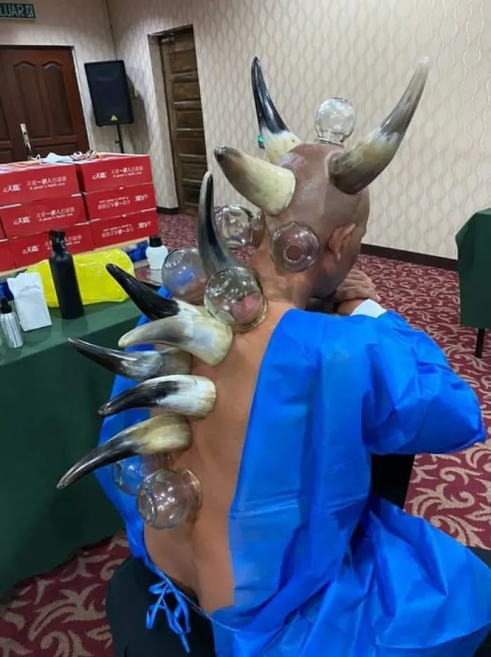 Hombre con ventosas y cuernos en la espalda en entorno inusual, destacando en imágenes raras.