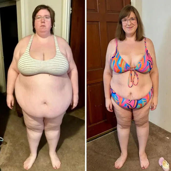 F/29/5’7 [430 > 215 = 215 Pounds Lost] 16 Months | Half The Person I Used To Be