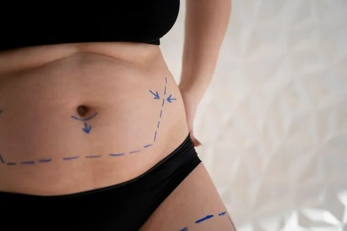 32 Cosmetic Procedures And Surgeries That Are Actually Possible Despite Sounding Kind Of Crazy
