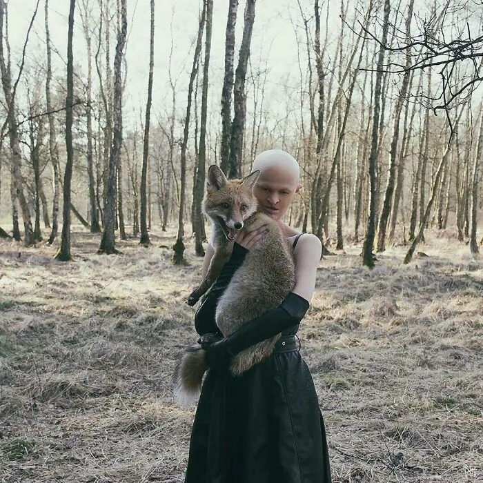 Meet Melanie Gaydos, A Striking Model Who Has Made The Most Of Her Rare Genetic Disorder
