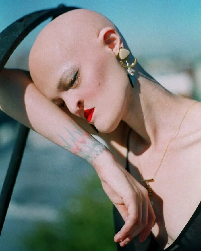 Meet Melanie Gaydos, A Striking Model Who Has Made The Most Of Her Rare Genetic Disorder