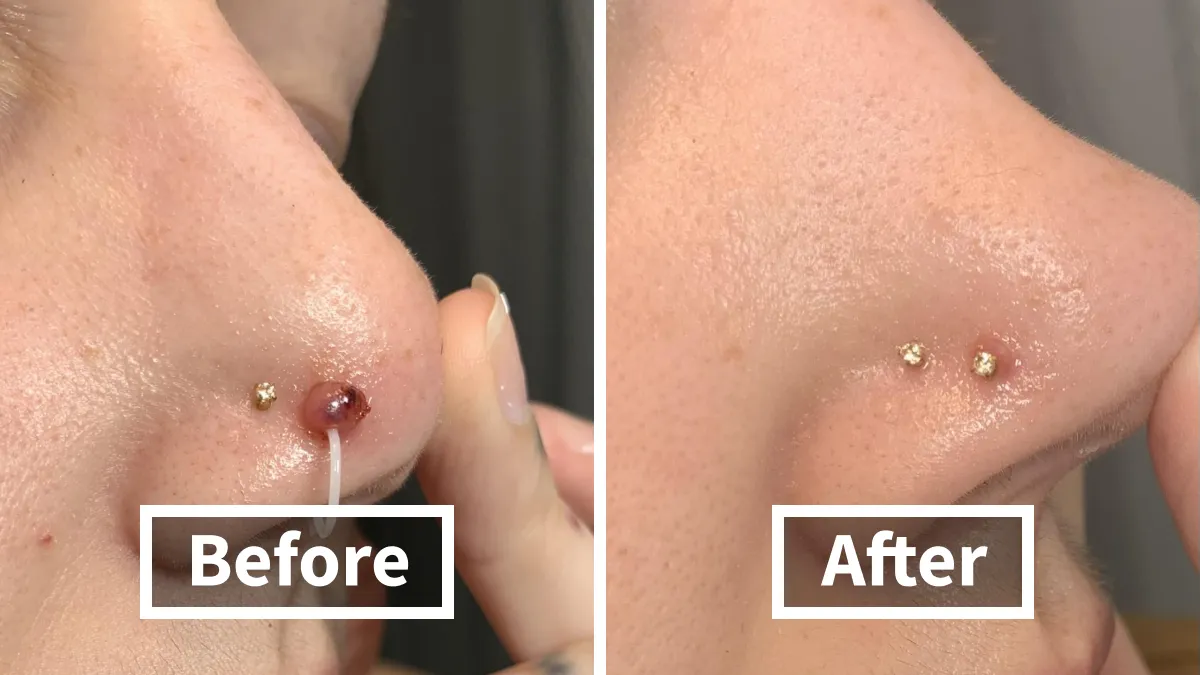 These 24 Before/Afters Are Making Us Poor And We’re Not Mad
