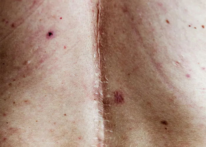 30 Features That Most Find Unattractive But For Folks In This Online Thread, It’s The Opposite