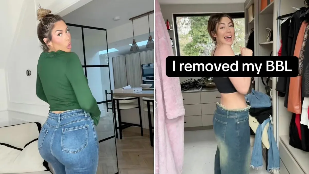 Woman Flaunts New Figure After Getting BBL Removed, Hitting 'Rock Bottom' Over Botched Surgeries