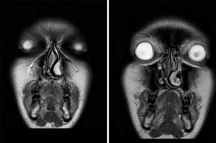 Disturbing MRI images showing ghostly features create an oddly terrifying effect.