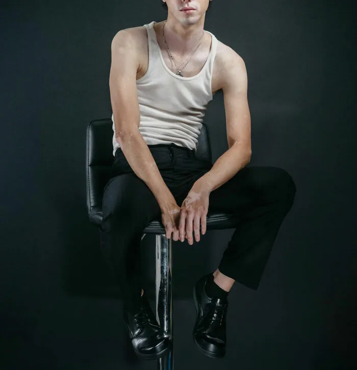 "Hip Dips!": 30 Conventionally Unattractive Features That These People Find Beautiful