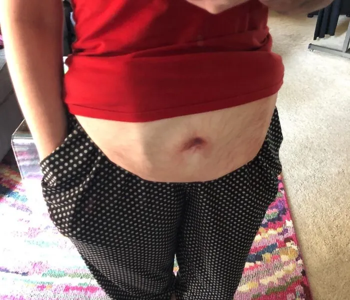 Person with shirt lifted over the stomach, in polka dot pants, demonstrating a playful visual prank.