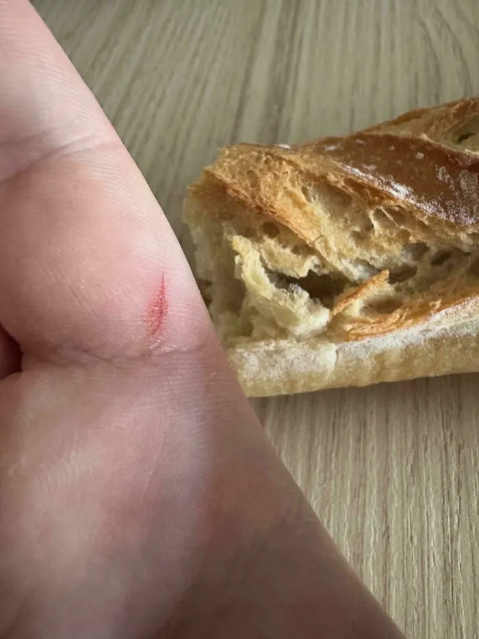 I Cut Myself With The Crust Of A Baguette