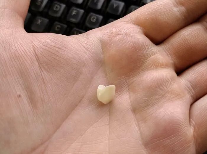 Estornudé en el trabajo y mi corona salió volando