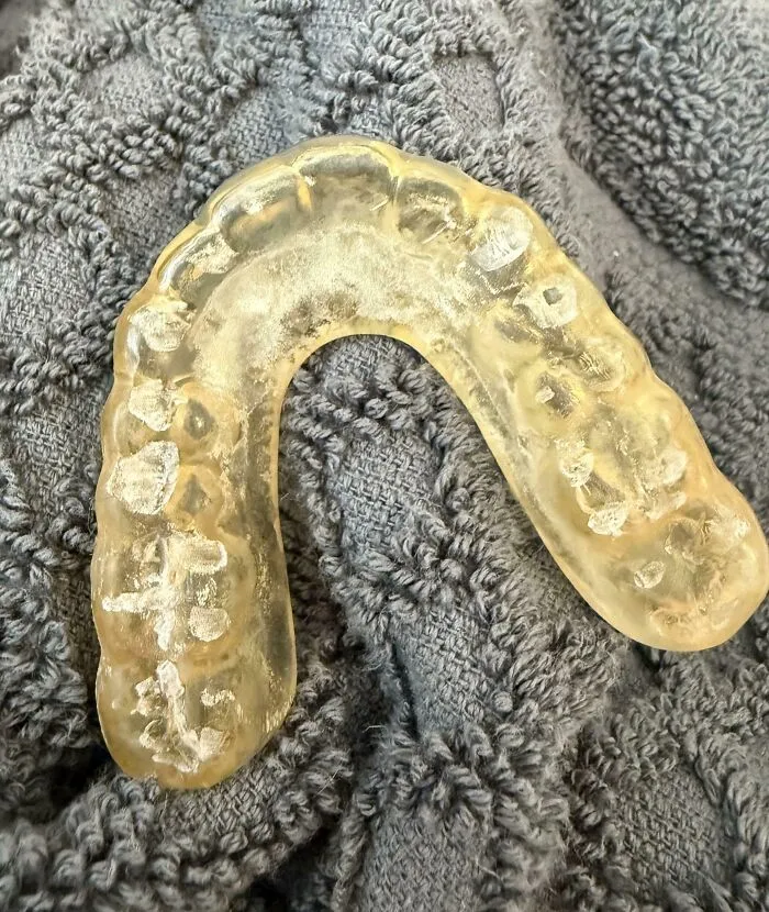 I Grind My Teeth So Hard At Night That I’m Wearing Through My Night Guard