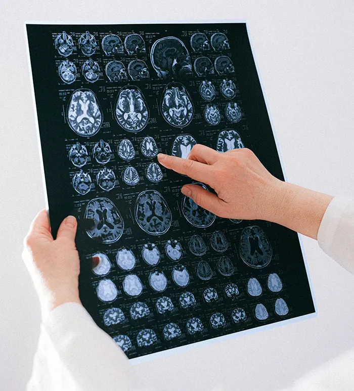 30 Doctors Reveal The Most Baffling Things About The Human Body They Have No Answers For