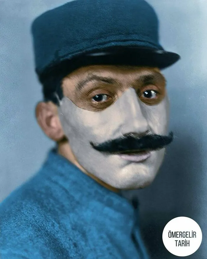 A French Soldier With Facial Prosthetics, 1918