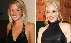 Going Under The Knife Has Had Some Brutal Effects On These 23 Celebrities