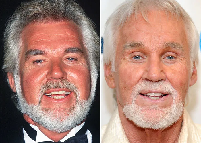 Kenny Rogers