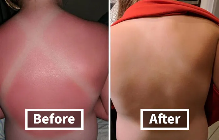 Soak Up The Sun, Then Soothe Your Skin With The <a Style="Display:inline;" Href="Https://Www.amazon.com/Burts-Bees-Coconut-Soother-Sunburn/Dp/B0013l55u0?ie=utf8&th=1&linkcode=ll1&tag=bpapple-20&linkid=a57fdae4d6e092d672a047f4a1b742c0&language=en_us&ref_=as_li_ss_tl" Target="_blank"><span Style="Font: Inherit; Color: #d74b1f;"> Burt's Bees After Sun Lotion</Span>, A Cooling Dose Of TLC For Your Parched Skin!