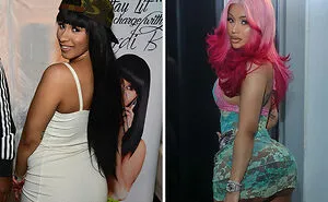Going Under The Knife Has Had Some Brutal Effects On These 23 Celebrities