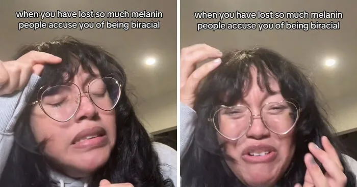 Black Woman With Stage 4 Cancer Films Melanin Loss That Has People Calling Her 'Biracial'