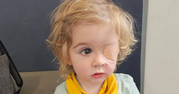 "Horrific!": Toddler At Risk Of Losing His Eye After Being Kissed By Someone With Herpes Virus