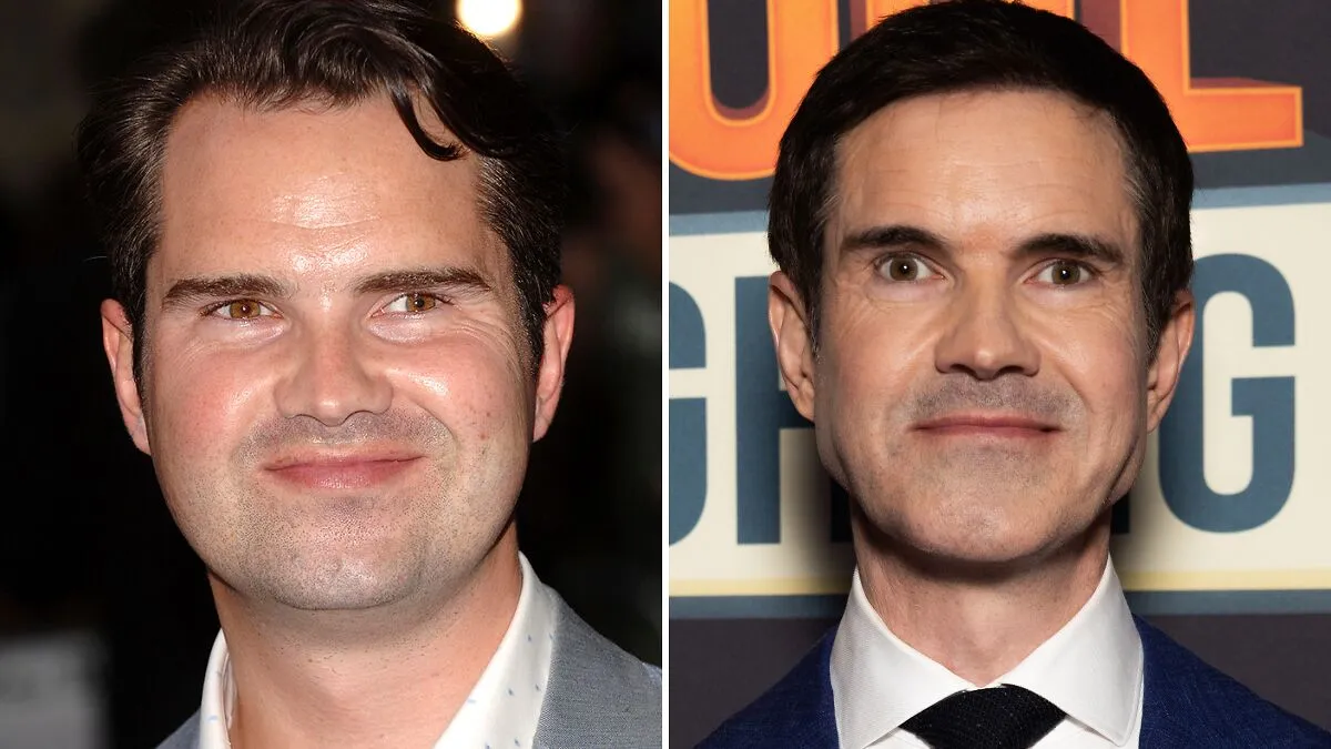 "He's Aged 20 Years": Jimmy Carr Admits He Can't Stop Getting Cosmetic "Tweakments"